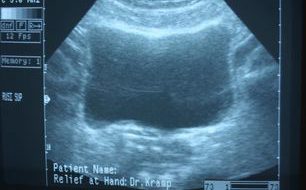 ultrasound-evolution-medical-associates